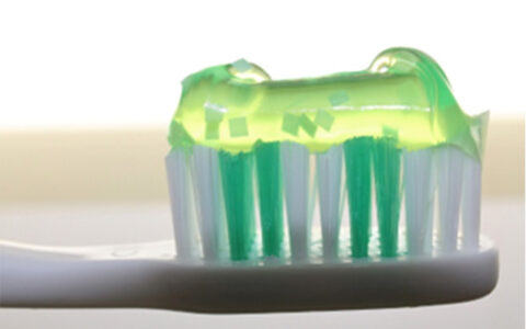 歯列矯正中の虫歯予防に有効なフッ素の使い方とは