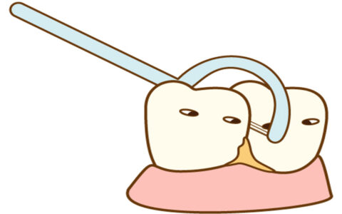 歯周病ってどこまで回復するの？