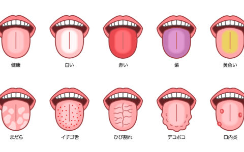 舌の色で体調チェック