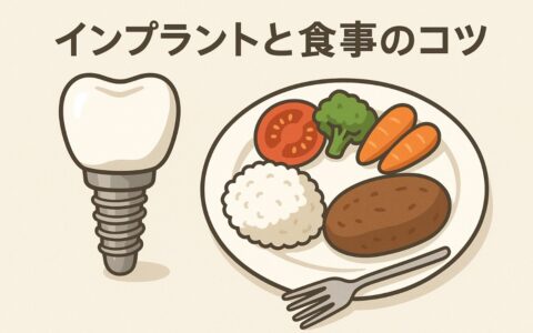 インプラントのために気を付けたい食事と噛み方のコツ