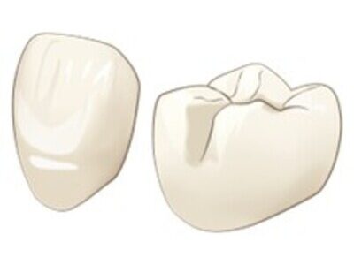 きれいで丈夫なかぶせものセラミック