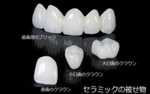 白く自然な歯に ― セラミック治療という選択肢 ―