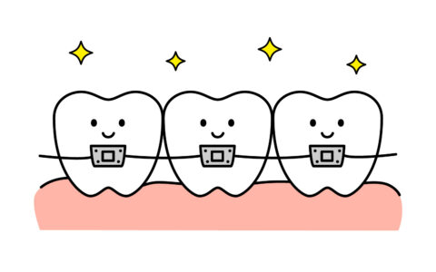 健康のための歯列矯正