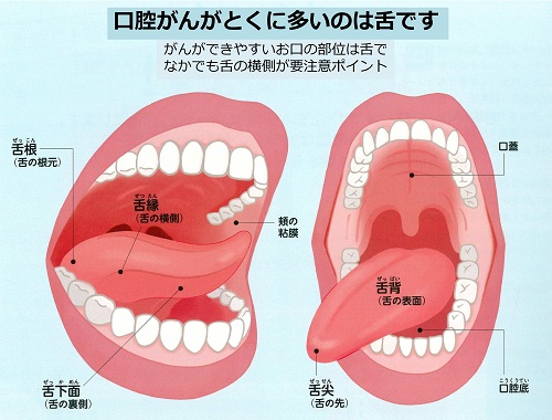 口腔がんってどんなもの？（口腔がんシリーズ1） | 医療法人社団徳治 